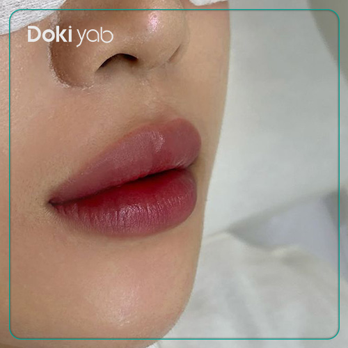 عکس ژل لب گرد و کره‌ای