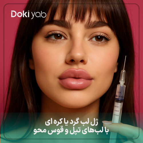 ژل لب گرد یا کره ای با لب های تپل و قوس محو