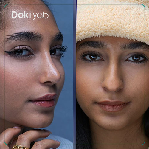 قبل و بعد عمل بینی با بهترین جراح بینی در تهران؛ دکی یاب