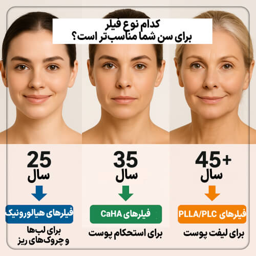 جدول تصویری انتخاب فیلر صورت بر اساس سن – ۲۵ سال، ۳۵ سال و ۴۵ سال به بالا (1)