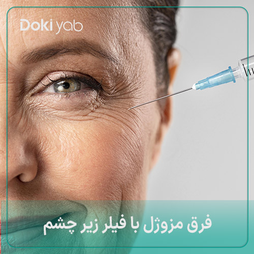 فرق مزوژل با فیلر زیر چشم