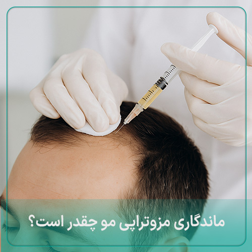 ماندگاری مزوتراپی مو چقدر است؟ بررسی 8 عامل موثر افزایش دوام
