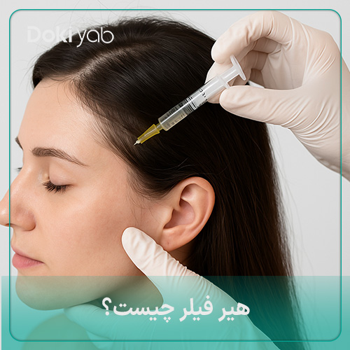 هیر فیلر چیست؟ مزایا + تجربه های واقعی + عکس قبل و بعد