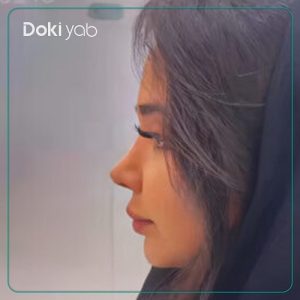 نمونه کار دکتر مسعود یزدانی در تهران