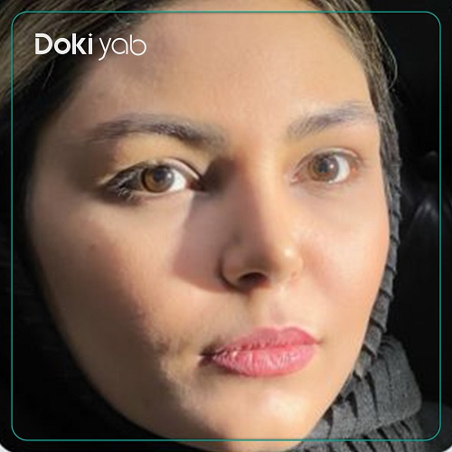 جراحی بینی دکتر امیر دریانی در تهران