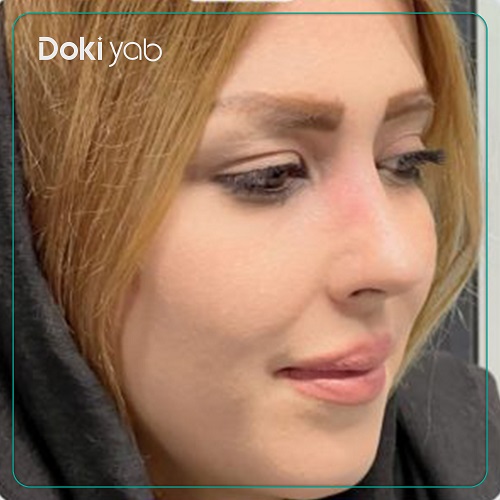 نمونه جراحی بینی دکتر امیر دریانی در تهران