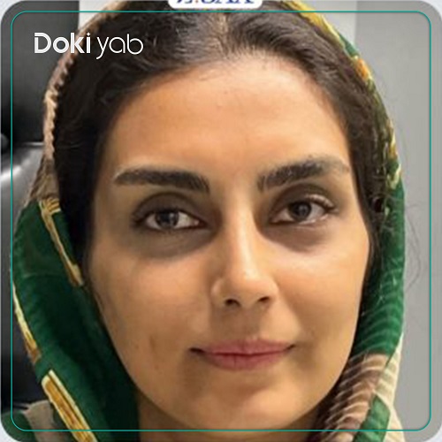 نمونه عمل بینی دکتر امیر دریانی جراح بینی در تهران