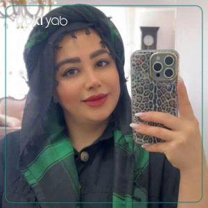 نمونه جراحی بینی دکتر هادی سرمست در تهران