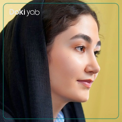 نمونه عمل بینی دکتر هادی سرمست جراح بینی تهران