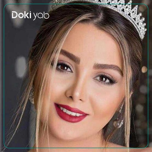 نمونه عمل بینی دکتر بهرام مقدم فرد در تهران