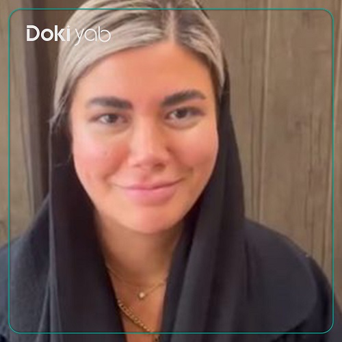 نمونه جراحی بینی دکتر بهرام مقدم فرد در تهران