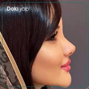 نمونه کار دکتر حمید نوری جراح بینی در تهران