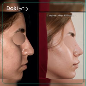 نمونه کار دکتر شهریار یحیوی در تهران