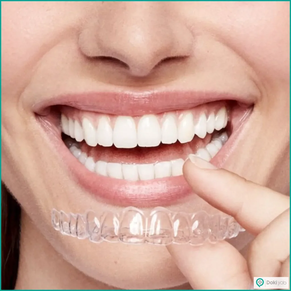 ارتودنسی نامرئی بدون سیم