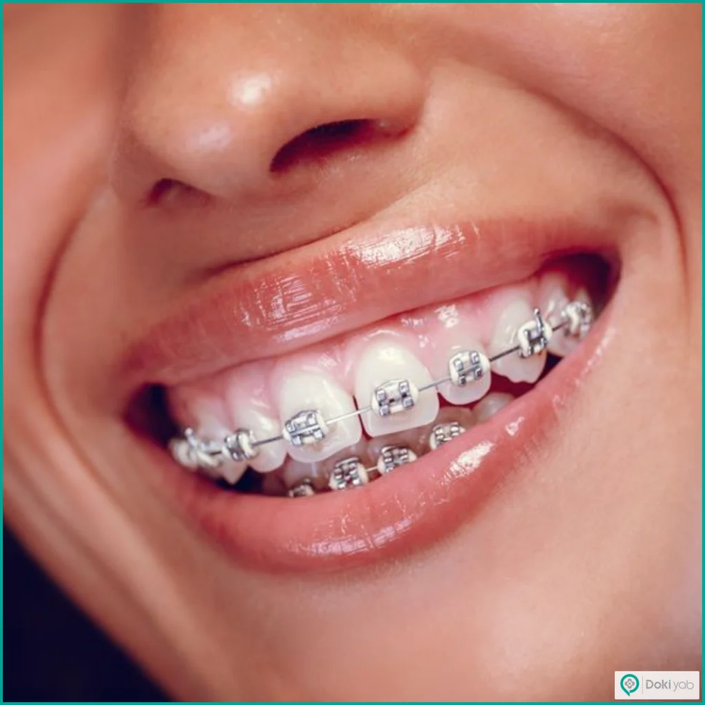 ارتودنسی جبرانی بدون جراحی فک
