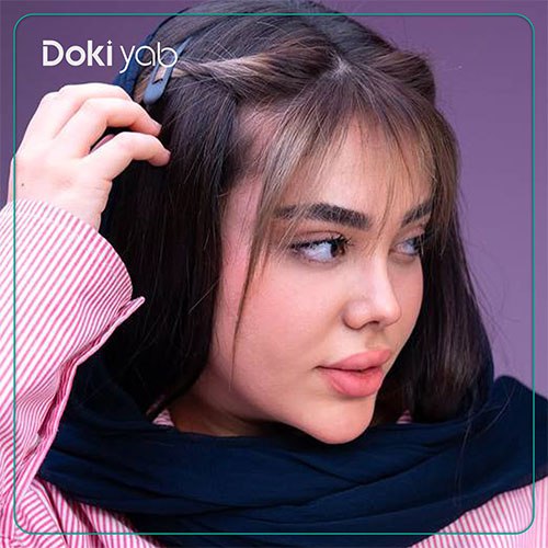 نمونه کار جراحی بینی نیمه فانتزی دکتر حمزه هاشمی در شیراز