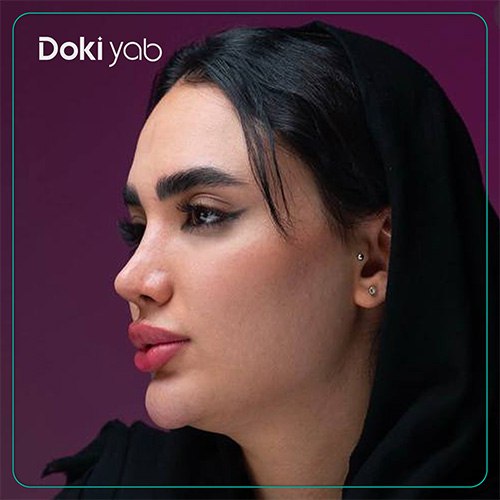 نمونه جراحی بینی به سبک نیمه فانتزی دکتر حمزه هاشمی در شیراز