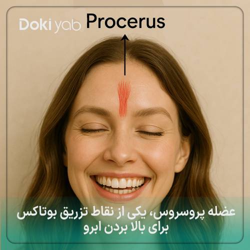 عضله پروسروس یکی از نقاط بالا بردن ابرو با بوتاکس 