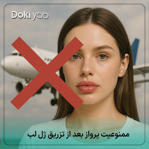 راهنمای تصویری ممنوعیت پرواز بعد از تزریق ژل لب