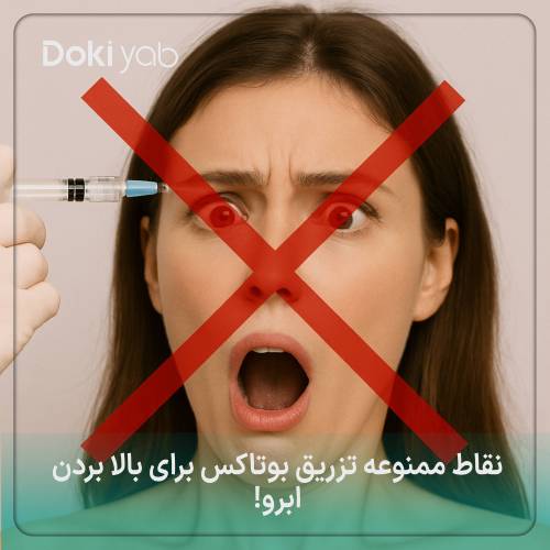 نقاط ممنوعه تزریق بوتاکس برای لیفت ابرو 
