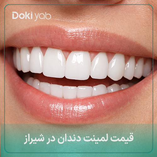 بررسی دقیق قیمت لمینت در شیراز