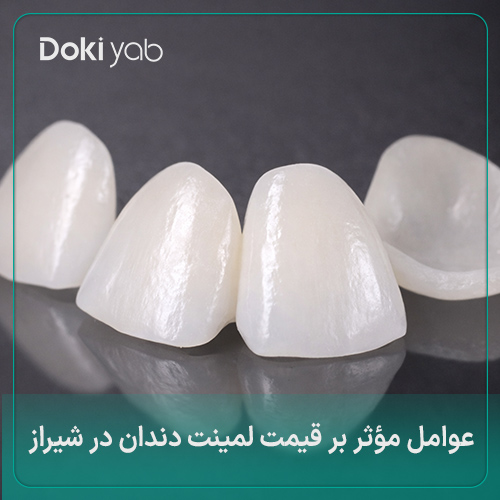 بررسی عوامل موثر بر هزینه لمینت در شیراز