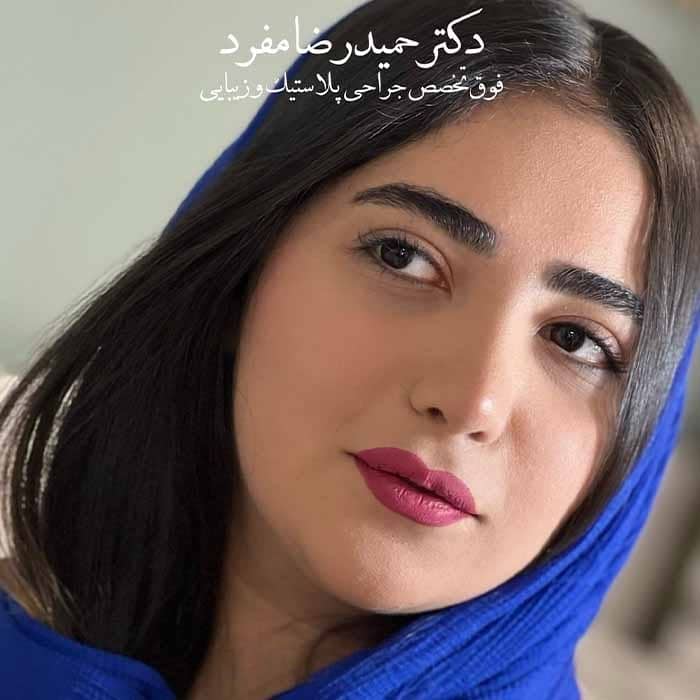 نمونه کار دکتر حمیدرضا مفرد در تهران