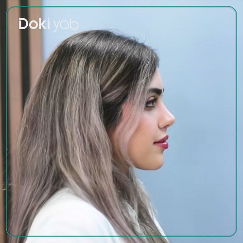 جراحی بینی دکتر نجات پور در تهران