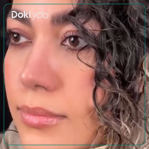 عمل بینی احمدرضا رجایی جراح بینی در تهران