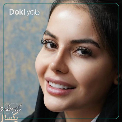 نمونه کار عمل بینی دکتر معتقدی جراح بینی در تهران