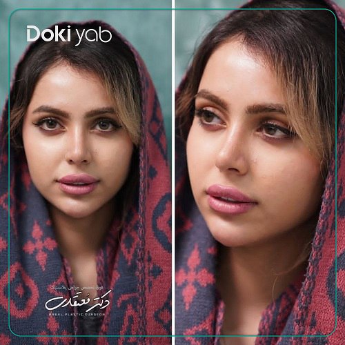 نمونه کار دکتر بابک معتقدی در تهران