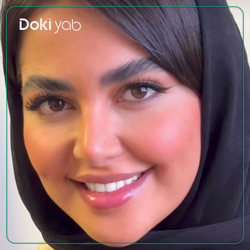نمونه عمل بینی دکتر سام تویسرکانی در تهران