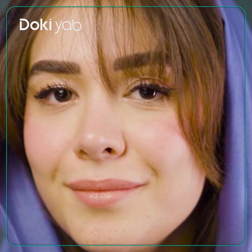 عمل بینی با دکتر حسام اسکندرزاده جراح بینی در تهران