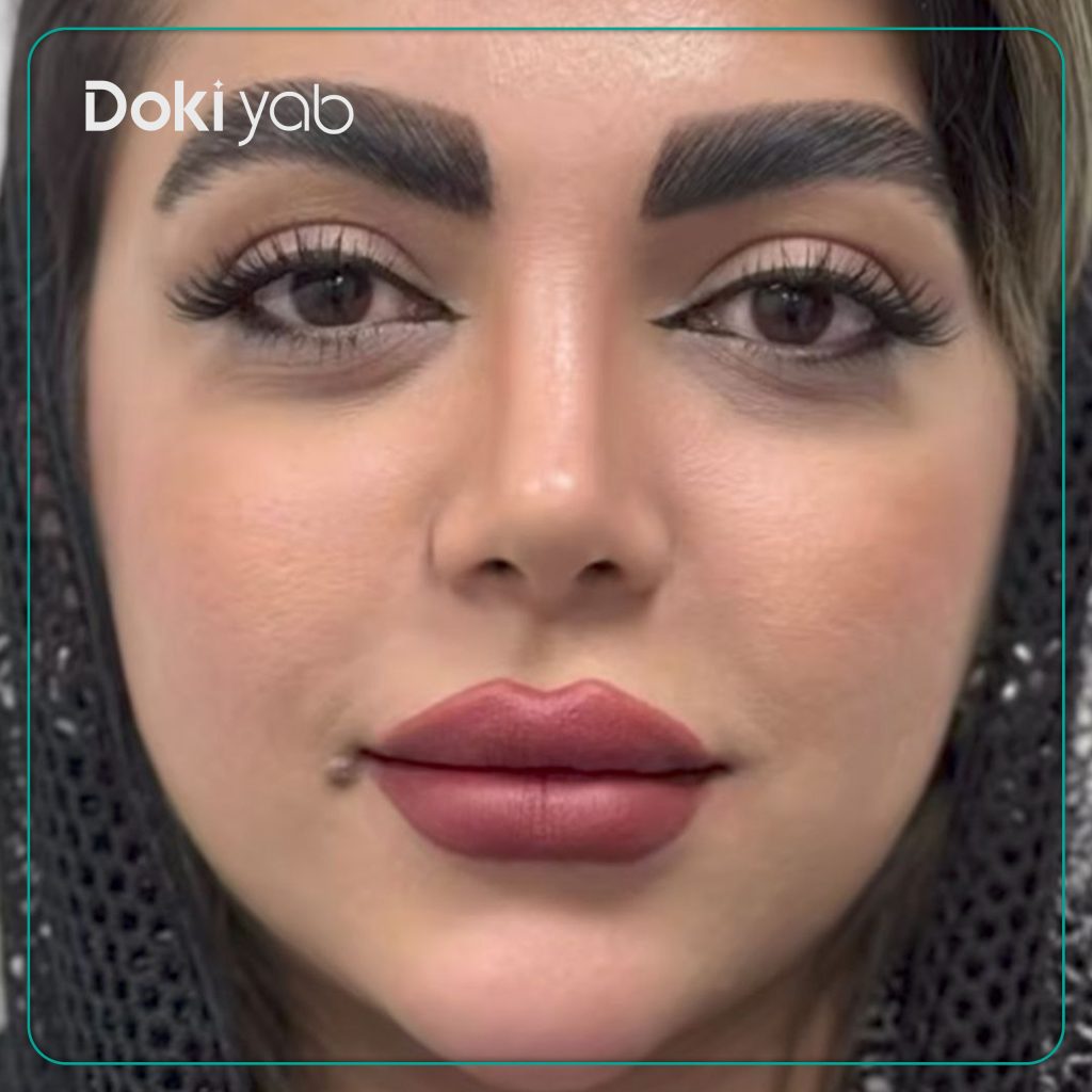 نمونه کار عمل بینی دکتر حمیدرضا مفرد در تهران