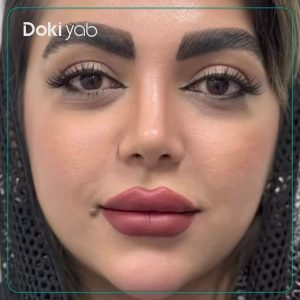 نمونه کار عمل بینی دکتر حمیدرضا مفرد در تهران