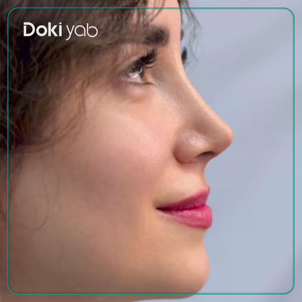 نمونه کار دکتر حمیدرضا مفرد در تهران