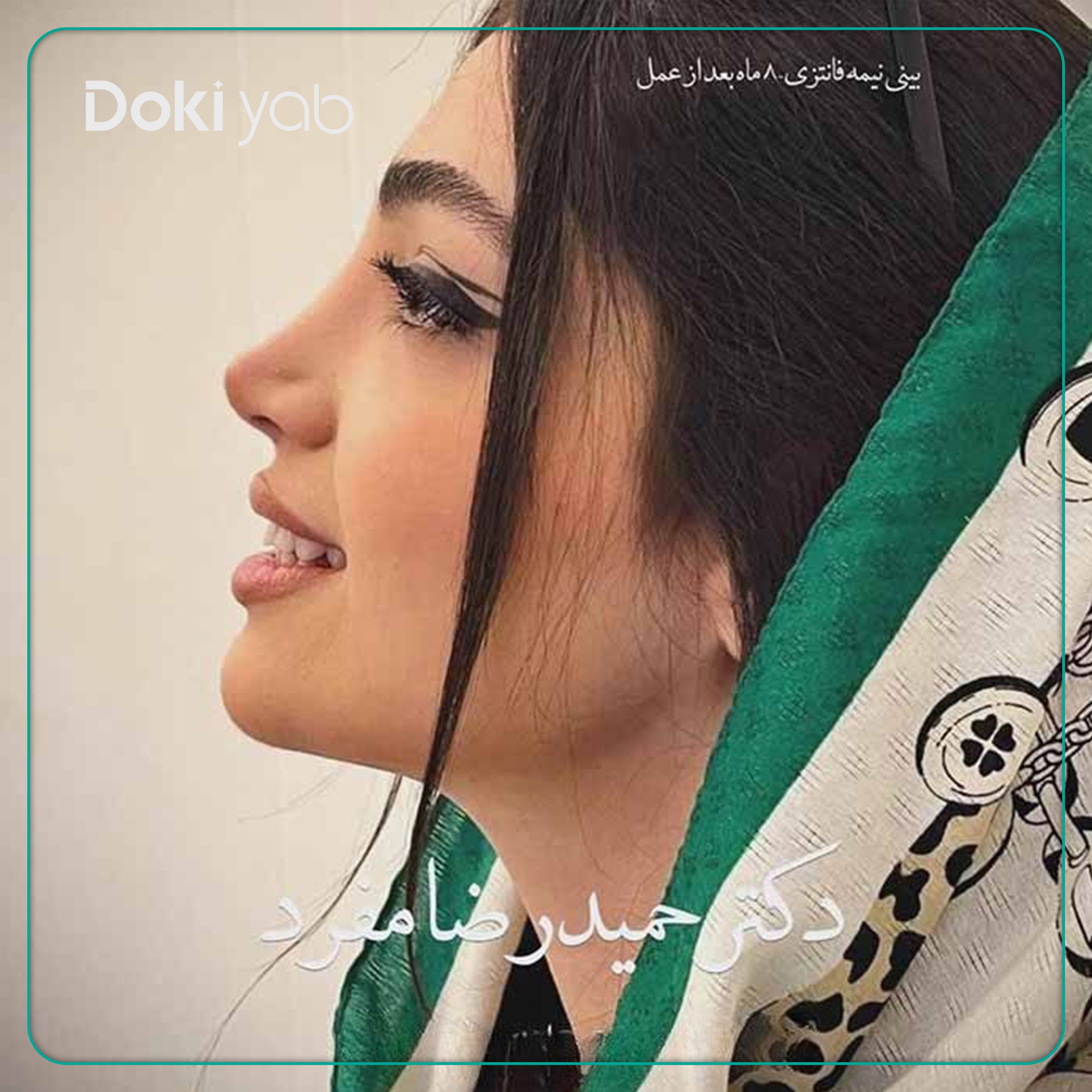 نمونه عمل بینی با دکتر حمیدرضا مفرد جراح بینی در تهران