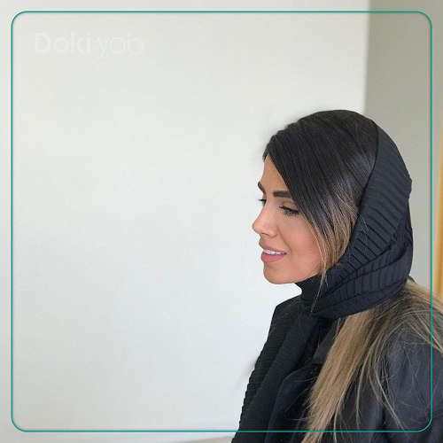 نمونه عمل بینی دکتر علی زینلی گلابی در تهران