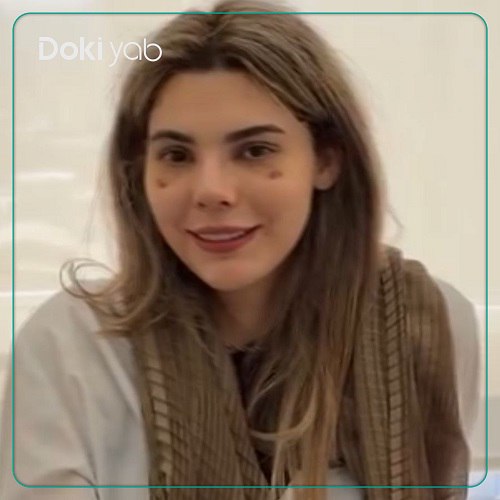 نمونه کار دکتر علی زینلی جراح بینی در تهران