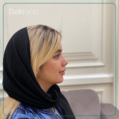 نمونه کار دکتر علی زینلی جراح بینی در تهران