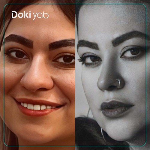 عمل بینی دکتر پوریا افلاکی جراح بینی در تهران