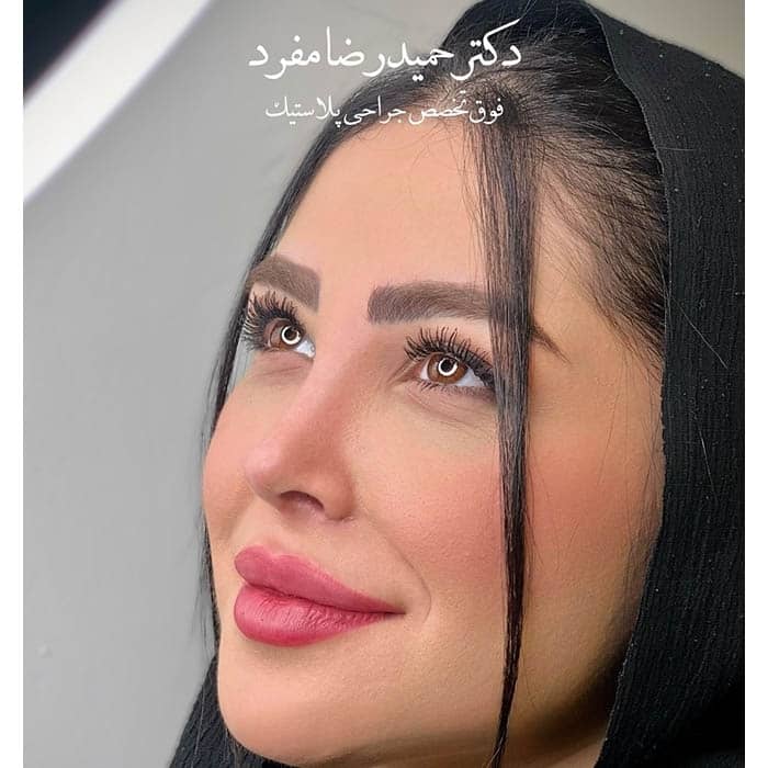 نمونه کار دکتر حمیدرضا مفرد در تهران