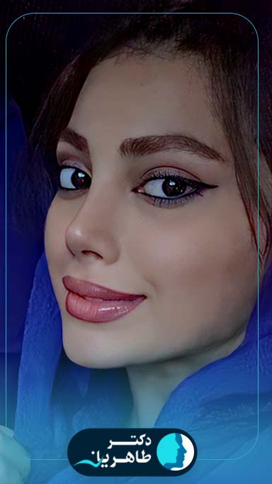 نمونه کار عمل بینی دکتر محمدحسین طاهریان در تهران