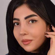 نمونه کار دکتر علیرضا سلطانیفر جراح بینی در تهران