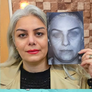 نمونه کار عمل بینی دکتر محمدحسین طاهریان جراح بینی در تهران