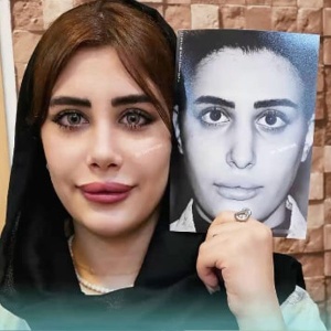 نمونه کار عمل بینی دکتر محمدحسین طاهریان جراح بینی در تهران