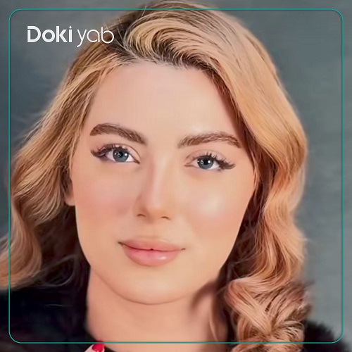 نمونه عمل بینی با دکتر جواد خالقی جراح بینی تهران