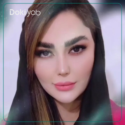 نمونه کار دکتر مهشید خورده چی جراح بینی اصفهان