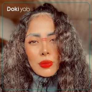 نمونه عمل بینی زنانه دکتر مهشید خورده چی در اصفهان