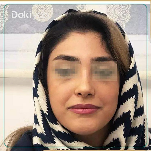 جراحی بینی دکتر مجید راستی در اصفهان